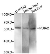 PDIA2 Antibody - Western blot analysis of extracts of various cell lines, using PDIA2 antibody at 1:3000 dilution. The secondary antibody used was an HRP Goat Anti-Rabbit IgG (H+L) at 1:10000 dilution. Lysates were loaded 25ug per lane and 3% nonfat dry milk in TBST was used for blocking. An ECL Kit was used for detection and the exposure time was 90s.
