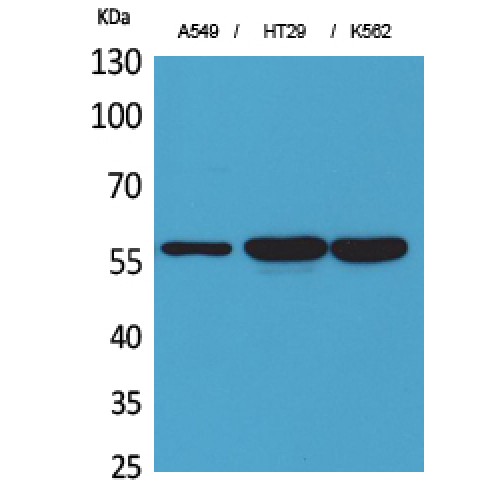 PDIA3 / ERp57 Antibody - Western blot of ERp57 antibody
