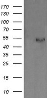 PDIA3 / ERp57 Antibody - HEK293T cells were transfected with the pCMV6-ENTRY control (Left lane) or pCMV6-ENTRY PDIA3 (Right lane) cDNA for 48 hrs and lysed. Equivalent amounts of cell lysates (5 ug per lane) were separated by SDS-PAGE and immunoblotted with anti-PDIA3.