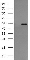 PDIA3 / ERp57 Antibody - HEK293T cells were transfected with the pCMV6-ENTRY control (Left lane) or pCMV6-ENTRY PDIA3 (Right lane) cDNA for 48 hrs and lysed. Equivalent amounts of cell lysates (5 ug per lane) were separated by SDS-PAGE and immunoblotted with anti-PDIA3.