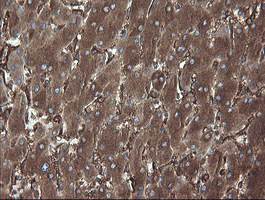 PDIA3 / ERp57 Antibody - IHC of paraffin-embedded Human liver tissue using anti-PDIA3 mouse monoclonal antibody. (Heat-induced epitope retrieval by 10mM citric buffer, pH6.0, 120°C for 3min).