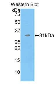 PDIA3 / ERp57 Antibody - Western blot of recombinant PDIA3 / ERp57.  This image was taken for the unconjugated form of this product. Other forms have not been tested.