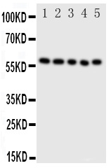 PDIA3 / ERp57 Antibody - Anti-ERp57 antibody, Western blotting Lane 1: SMMC Cell Lysate Lane 2: A549 Cell LysateLane 3: U87 Cell LysateLane 4: HELA Cell LysateLane 5: MCF-7 Cell Lysate