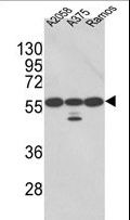 PDIA3 / ERp57 Antibody - Western blot of PDIA3 Antibody in A2058, A375, Ramos cell line lysates (35 ug/lane). PDIA3 (arrow) was detected using the purified antibody.(2 ug/ml)