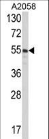 PDIA3 / ERp57 Antibody - Western blot of PDIA3 Antibody in A2058 cell line lysates (35 ug/lane). PDIA3 (arrow) was detected using the purified antibody.
