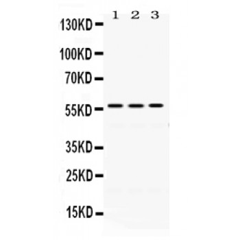 PDIA3 / ERp57 Antibody - ERp57 antibody Western blot. All lanes: Anti ERp57 at 0.5 ug/ml. Lane 1: Rat Liver Tissue Lysate at 50 ug. Lane 2: Mouse Liver Tissue Lysate at 50 ug. Lane 3: A549 Whole Cell Lysate at 40 ug. Predicted band size: 57 kD. Observed band size: 57 kD.