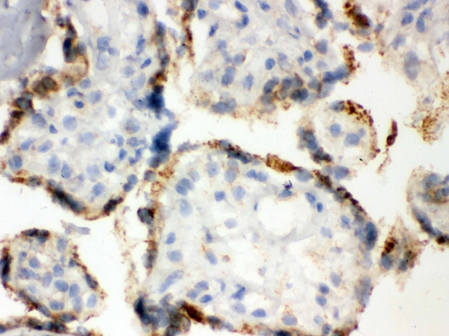 PDIA3 / ERp57 Antibody - IHC analysis of ERp57 using anti-ERp57 antibody. ERp57 was detected in frozen section of human placenta tissue . Heat mediated antigen retrieval was performed in citrate buffer (pH6, epitope retrieval solution) for 20 mins. The tissue section was blocked with 10% goat serum. The tissue section was then incubated with 1µg/ml rabbit anti-ERp57 Antibody overnight at 4°C. Biotinylated goat anti-rabbit IgG was used as secondary antibody and incubated for 30 minutes at 37°C. The tissue section was developed using Strepavidin-Biotin-Complex (SABC) with DAB as the chromogen.