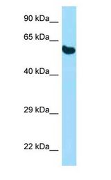 PDIA3 / ERp57 Antibody - PDIA3 / ERp57 antibody Western Blot of Mouse Pancreas.  This image was taken for the unconjugated form of this product. Other forms have not been tested.