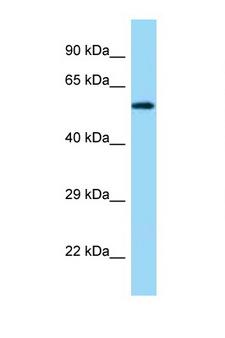 PDIA3 / ERp57 Antibody - PDIA3 / ERp57 antibody Western blot of Fetal Kidney lysate. Antibody concentration 1 ug/ml.  This image was taken for the unconjugated form of this product. Other forms have not been tested.