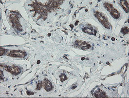PDIA3 / ERp57 Antibody - IHC of paraffin-embedded Human breast tissue using anti-PDIA3 mouse monoclonal antibody.