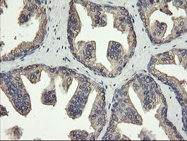 PDIA3 / ERp57 Antibody - IHC of paraffin-embedded Human prostate tissue using anti-PDIA3 mouse monoclonal antibody.