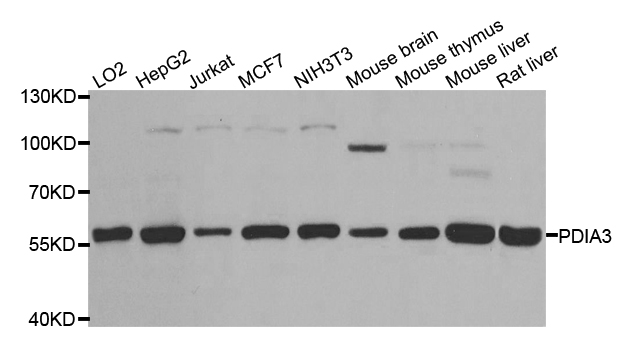 PDIA3 / ERp57 Antibody - Western blot analysis of extracts of various cell lines, using PDIA3 antibody at 1:1000 dilution. The secondary antibody used was an HRP Goat Anti-Rabbit IgG (H+L) at 1:10000 dilution. Lysates were loaded 25ug per lane and 3% nonfat dry milk in TBST was used for blocking. An ECL Kit was used for detection and the exposure time was 30s.
