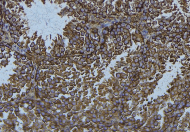 PDIA3 / ERp57 Antibody - 1:100 staining mouse testis tissue by IHC-P. The sample was formaldehyde fixed and a heat mediated antigen retrieval step in citrate buffer was performed. The sample was then blocked and incubated with the antibody for 1.5 hours at 22°C. An HRP conjugated goat anti-rabbit antibody was used as the secondary.