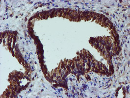 PDIA4 / ERP72 Antibody - IHC of paraffin-embedded Human prostate tissue using anti-PDIA4 mouse monoclonal antibody.