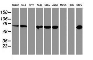 PDIA4 / ERP72 Antibody - Western blot of extracts (35ug) from 9 different cell lines by using anti-PDIA4 monoclonal antibody (HepG2: human; HeLa: human; SVT2: mouse; A549: human; COS7: monkey; Jurkat: human; MDCK: canine; PC12: rat; MCF7: human).