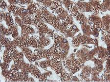 PDIA4 / ERP72 Antibody - IHC of paraffin-embedded Human liver tissue using anti-PDIA4 mouse monoclonal antibody. (Heat-induced epitope retrieval by 10mM citric buffer, pH6.0, 100C for 10min).