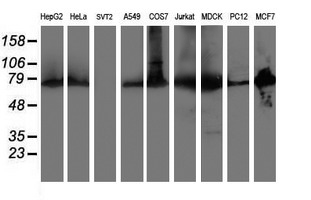 PDIA4 / ERP72 Antibody - Western blot of extracts (35ug) from 9 different cell lines by using anti-PDIA4 monoclonal antibody.