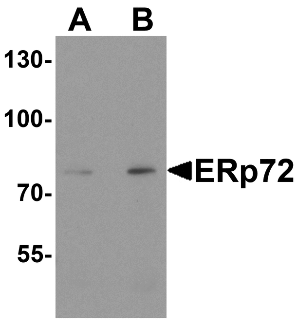 PDIA4 / ERP72 Antibody - Western blot analysis of ERp72 in human colon tissue lysate with ERp72 antibody at (A) 1 and (B) 2 ug/ml.