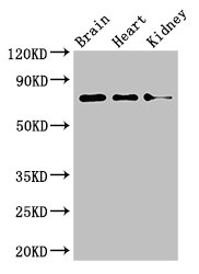 PDIA4 / ERP72 Antibody - Western Blot Positive WB detected in: Mouse brain tissue, Mouse heart tissue, Mouse kidney tissue All lanes: PDIA4 antibody at 4µg/ml Secondary Goat polyclonal to rabbit IgG at 1/50000 dilution Predicted band size: 73 kDa Observed band size: 73 kDa