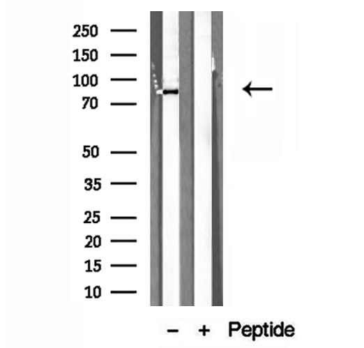 PDIA4 / ERP72 Antibody - Western blot analysis of extracts of HepG2 cells using ERp72 antibody.
