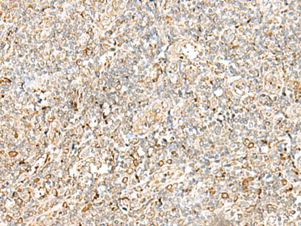 PDIA4 / ERP72 Antibody - Immunohistochemistry of paraffin-embedded Human tonsil tissue  using PDIA4 Polyclonal Antibody at dilution of 1:40(×200)