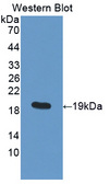 PDIA5 / PDIR Antibody - Western blot of PDIA5 / PDIR antibody.