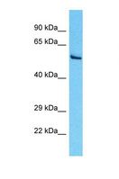 PDIA5 / PDIR Antibody - Western blot of Human HepG2. PDIA5 antibody dilution 1.0 ug/ml.  This image was taken for the unconjugated form of this product. Other forms have not been tested.