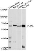 PDIA5 / PDIR Antibody - Western blot analysis of extracts of various cell lines, using PDIA5 antibody at 1:1000 dilution. The secondary antibody used was an HRP Goat Anti-Rabbit IgG (H+L) at 1:10000 dilution. Lysates were loaded 25ug per lane and 3% nonfat dry milk in TBST was used for blocking. An ECL Kit was used for detection and the exposure time was 30s.