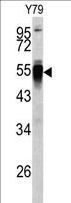 PDIA6 / ERP5 Antibody - Western blot of PDIA6 antibody (Center K159) in Y79 cell line lysates (35 ug/lane). PDIA6 (arrow) was detected using the purified antibody.