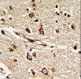 PDIA6 / ERP5 Antibody - Formalin-fixed and paraffin-embedded human brain tissue reacted with PDIA6 Antibody (Center K159), which was peroxidase-conjugated to the secondary antibody, followed by DAB staining. This data demonstrates the use of this antibody for immunohistochemistry; clinical relevance has not been evaluated.