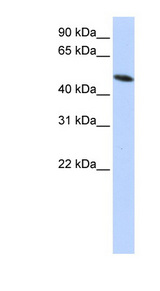 PDIA6 / ERP5 Antibody - PDIA6 antibody Western blot of HepG2 cell lysate. This image was taken for the unconjugated form of this product. Other forms have not been tested.