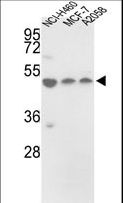 PDIA6 / ERP5 Antibody - Western blot of PDIA6 Antibody (Center D251) in NCI-H460, MCF-7, A2058 cell line lysates (35 ug/lane). PDIA6 (arrow) was detected using the purified antibody.