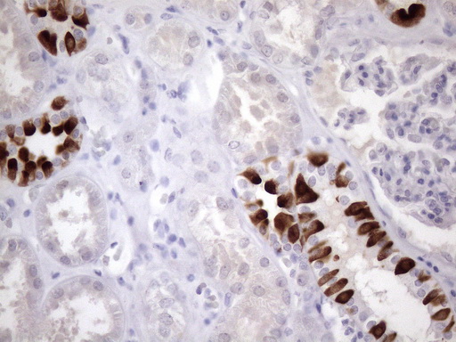 PDIA6 / ERP5 Antibody - Immunohistochemical staining of paraffin-embedded Human Kidney tissue within the normal limits using anti-ATP6V1C2 mouse monoclonal antibody. (Heat-induced epitope retrieval by 1mM EDTA in 10mM Tris buffer. (pH8.5) at 120 oC for 3 min. (1:150)