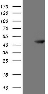 PDIA6 / ERP5 Antibody - HEK293T cells were transfected with the pCMV6-ENTRY control. (Left lane) or pCMV6-ENTRY ATP6V1C2. (Right lane) cDNA for 48 hrs and lysed. Equivalent amounts of cell lysates. (5 ug per lane) were separated by SDS-PAGE and immunoblotted with anti-ATP6V1C2. (1:2000)