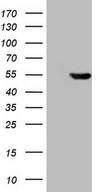 PDIA6 / ERP5 Antibody - HEK293T cells were transfected with the pCMV6-ENTRY control. (Left lane) or pCMV6-ENTRY ATP6V1C2. (Right lane) cDNA for 48 hrs and lysed. Equivalent amounts of cell lysates. (5 ug per lane) were separated by SDS-PAGE and immunoblotted with anti-ATP6V1C2. (1:2000)