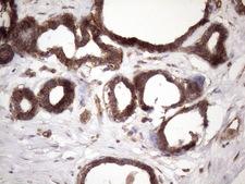 PDIA6 / ERP5 Antibody - Immunohistochemical staining of paraffin-embedded Human breast tissue within the normal limits using anti-ATP6V1C2 mouse monoclonal antibody. (Heat-induced epitope retrieval by 1mM EDTA in 10mM Tris buffer. (pH8.5) at 120 oC for 3 min. (1:150)