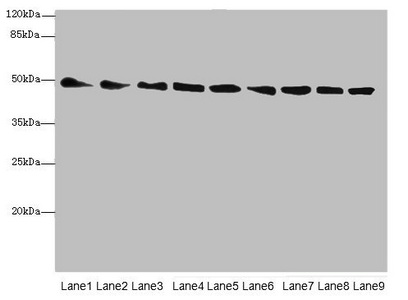 PDIA6 / ERP5 Antibody - Western blot All Lanes:PDIA6antibody at 5.9ug/ml Lane 1 : Mouse heart tissue Lane 2 : Mouse kidney tissue Lane 3 : Mouse lung tissue Lane 4 : Mouse liver tissue Lane 5 : 293T whole cell lysate Lane 6 : Hela whole cell lysate Lane 7 : HL60 whole cell lysate Lane 8 : HepG-2 whole cell lysate Lane 9 : Thp-1 whole cell lysate Secondary Goat polyclonal to Rabbit IgG at 1/10000 dilution Predicted band size: 49,54,48 kDa Observed band size: 48 kDa