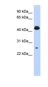 PDIK1L Antibody - PDIK1L antibody Western blot of MCF7 cell lysate. This image was taken for the unconjugated form of this product. Other forms have not been tested.