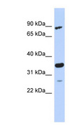 PDIK1L Antibody - PDIK1L antibody Western blot of MCF7 cell lysate. This image was taken for the unconjugated form of this product. Other forms have not been tested.