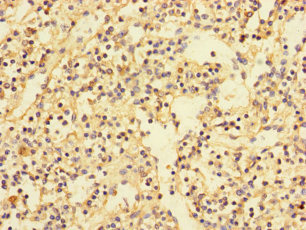 PDIK1L Antibody - Immunohistochemistry of paraffin-embedded human spleen tissue using PDIK1L Antibody at dilution of 1:100