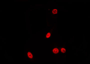 PDIK1L Antibody - Staining HeLa cells by IF/ICC. The samples were fixed with PFA and permeabilized in 0.1% Triton X-100, then blocked in 10% serum for 45 min at 25°C. The primary antibody was diluted at 1:200 and incubated with the sample for 1 hour at 37°C. An Alexa Fluor 594 conjugated goat anti-rabbit IgG (H+L) Ab, diluted at 1/600, was used as the secondary antibody.