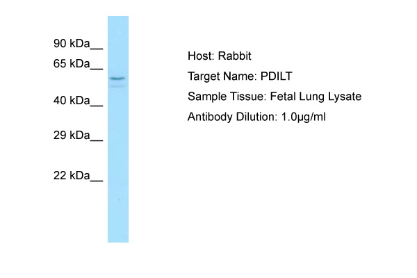 PDILT Antibody -  This image was taken for the unconjugated form of this product. Other forms have not been tested.