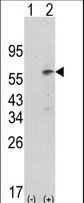 PDK1 Antibody - Western blot of PDK1 (arrow) using rabbit polyclonal hPDK1-G14. 293 cell lysates (2 ug/lane) either nontransfected (Lane 1) or transiently transfected with the PDK1 gene (Lane 2) (Origene Technologies).