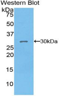 PDK1 Antibody - Western blot of recombinant PDK1.  This image was taken for the unconjugated form of this product. Other forms have not been tested.