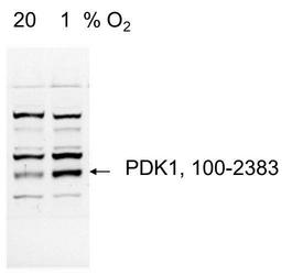 PDK1 Antibody - Detection of PDK1 in human heart lysate using antibody at 2 ug/ml.  This image was taken for the unconjugated form of this product. Other forms have not been tested.