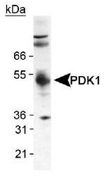 PDK1 Antibody - Detection of PDK1 in human heart lysate using PDK1 Antibody LS-B1733 at 2 ug/ml.  This image was taken for the unconjugated form of this product. Other forms have not been tested.