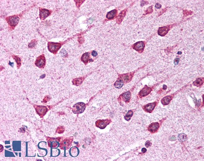 PDK1 Antibody - Anti-PDK1 antibody IHC of human brain, cortex. Immunohistochemistry of formalin-fixed, paraffin-embedded tissue after heat-induced antigen retrieval. Antibody concentration 5 ug/ml.  This image was taken for the unconjugated form of this product. Other forms have not been tested.