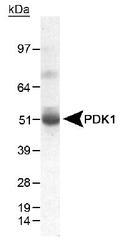 PDK1 Antibody - Detection of PDK1 in human heart lysate using antibody at 0.5 ug/ml.  This image was taken for the unconjugated form of this product. Other forms have not been tested.