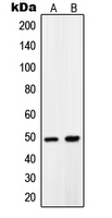 PDK1 Antibody - Western blot analysis of PDK1 expression in LNCaP (A); A431 (B) whole cell lysates.
