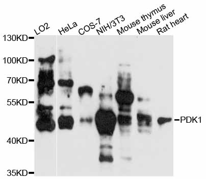 PDK1 Antibody - Western blot analysis of extracts of various cell lines, using PDK1 antibody at 1:3000 dilution. The secondary antibody used was an HRP Goat Anti-Rabbit IgG (H+L) at 1:10000 dilution. Lysates were loaded 25ug per lane and 3% nonfat dry milk in TBST was used for blocking. An ECL Kit was used for detection and the exposure time was 60s.